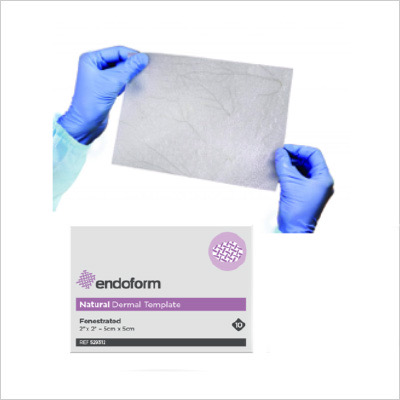 Endoform, Plantilla dérmica Natural fenestrada